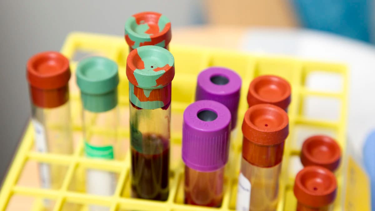 Preparing for a Drug Test